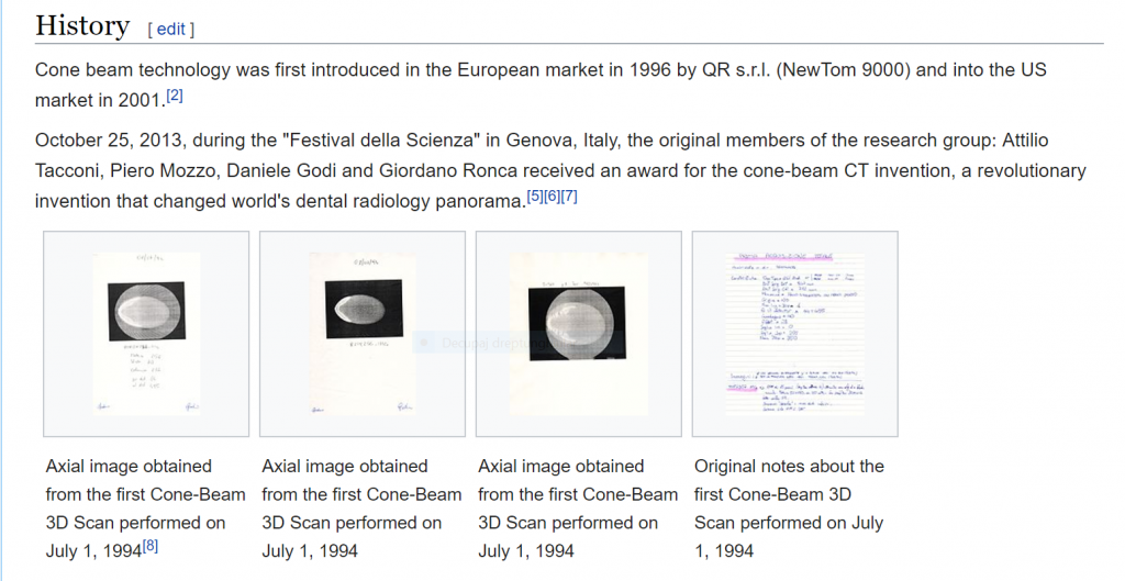 NewTom primul CBCT din lume