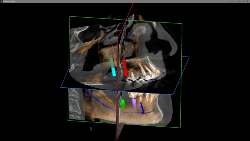 Profil CBCT
